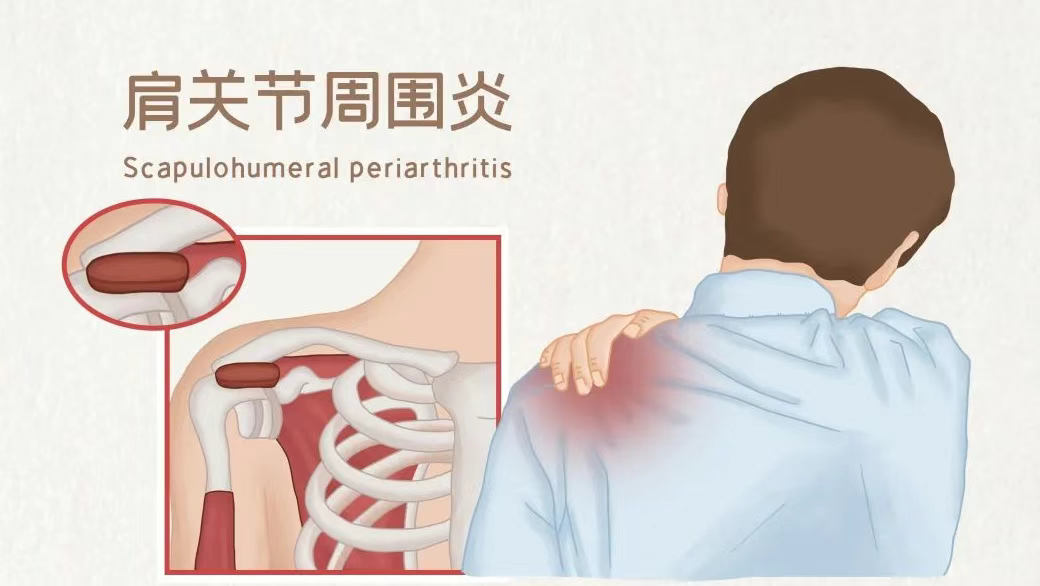 ce455af65f5cd488a5d8605613ca6d0c.png ce455af65f5cd488a5d8605613ca6d0c.png